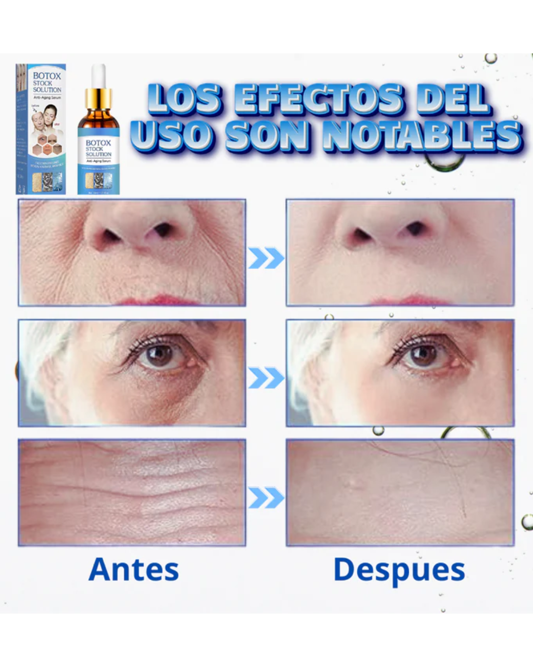 Botox Stock Solution suero antiarrugas